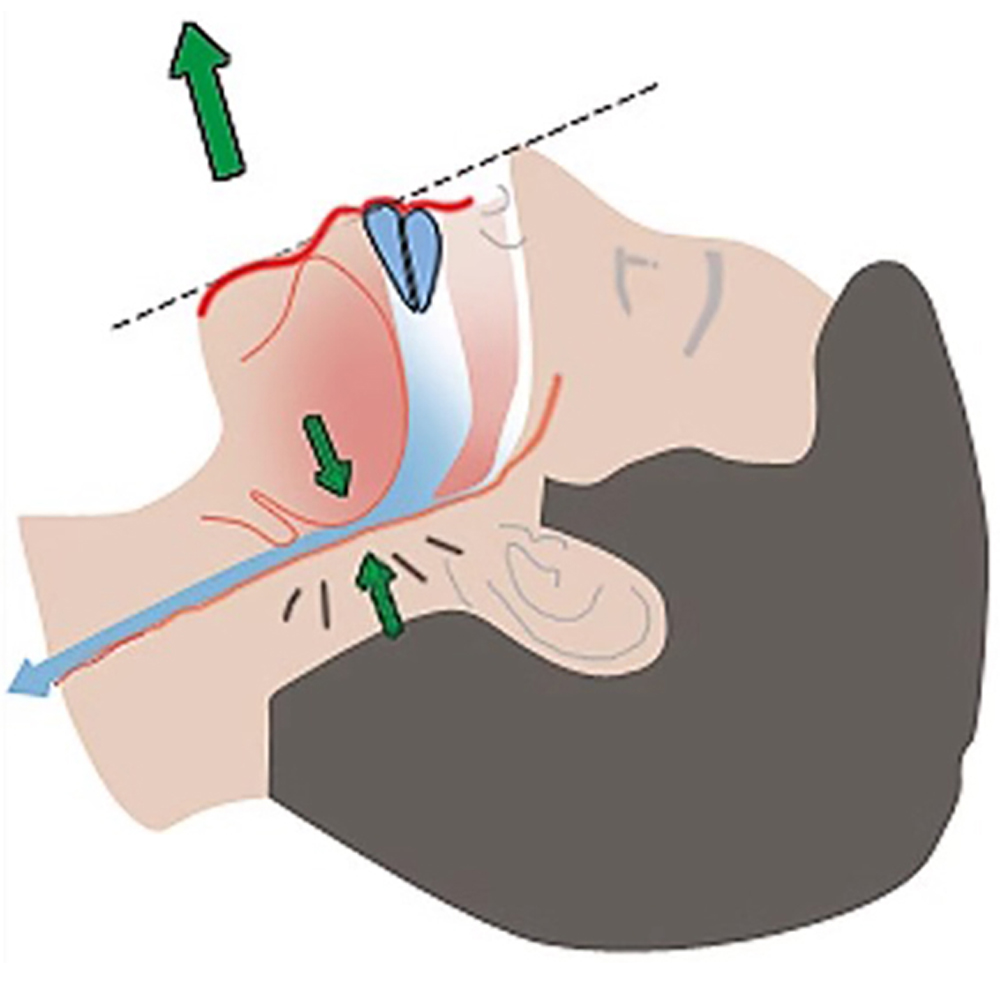 New White Box Anti-Snoring Sle - Dental Guard Night 리뷰 및 가격