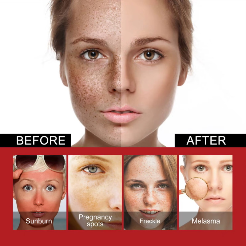 Powerful Spot-Removing Whiten  - Charcoal Whitening Paste 리뷰 및 가격