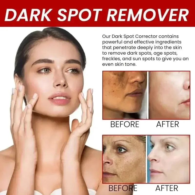 Powerful Spot-Removing Whiten  - Charcoal Whitening Paste 리뷰 및 가격