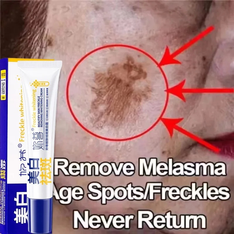 Powerful Spot-Removing Whiten  - Charcoal Whitening Paste 리뷰 및 가격