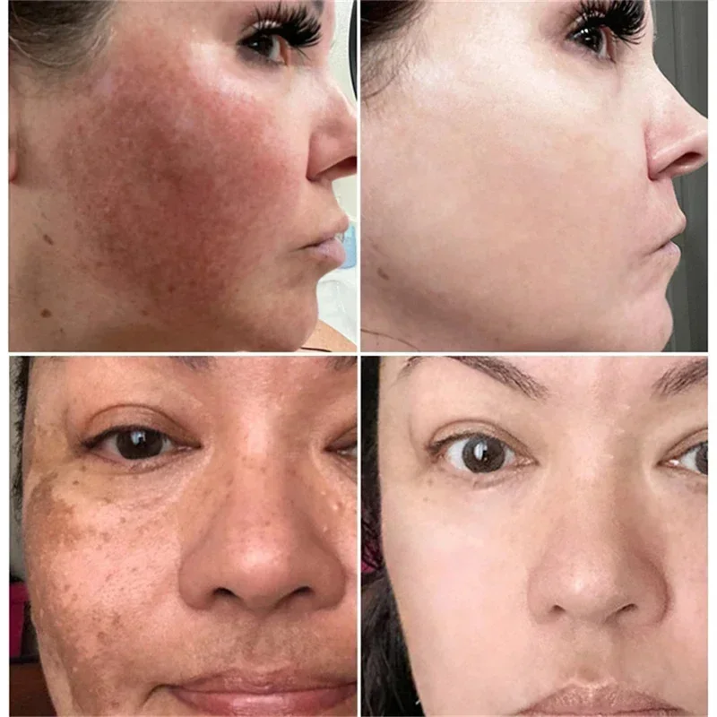 Powerful Spot-Removing Whiten  - Charcoal Whitening Paste 리뷰 및 가격