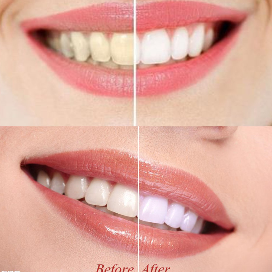 Bamboo Charcoal Teeth Tooth De - Teeth Paint Whitening 리뷰 및 가격