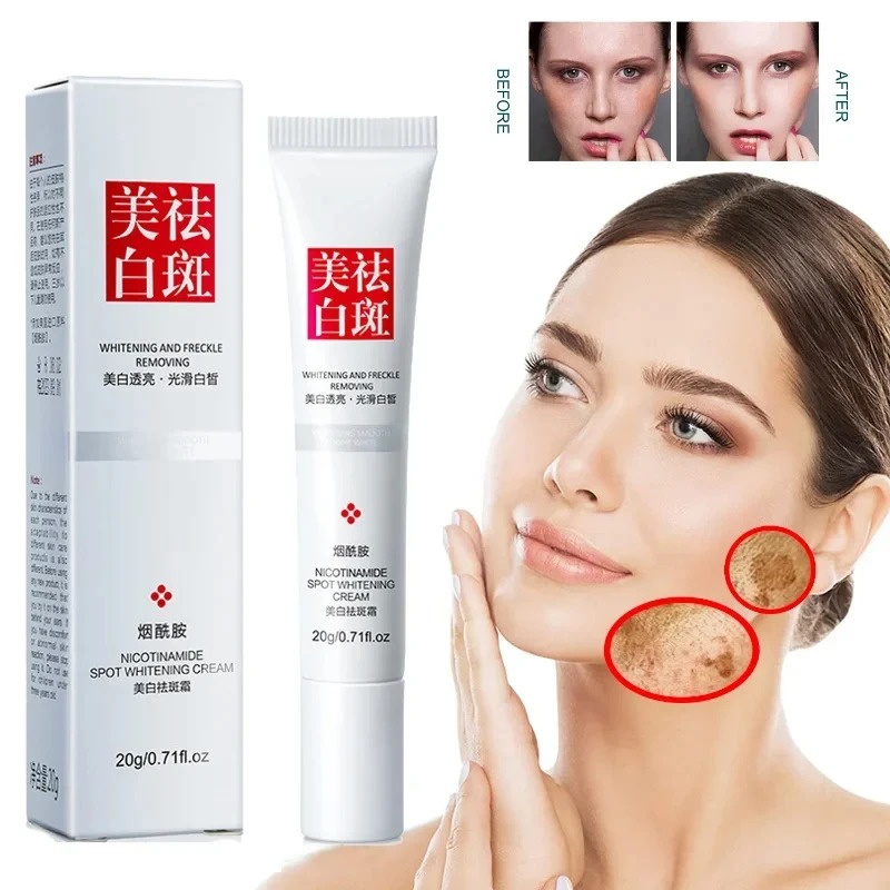 Fade and Improve Freckles Blac - Charcoal Whitening Paste 리뷰 및 가격