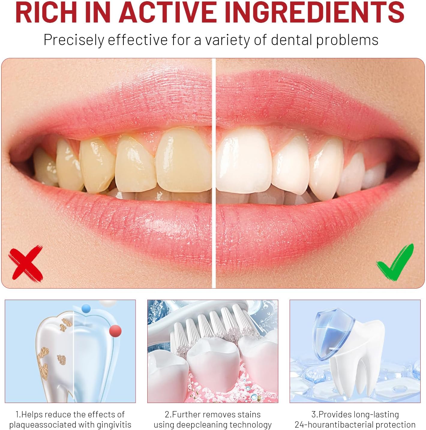 Niacinamide Whitening Toothpas - Teeth Whitening That Works 리뷰 및 가격