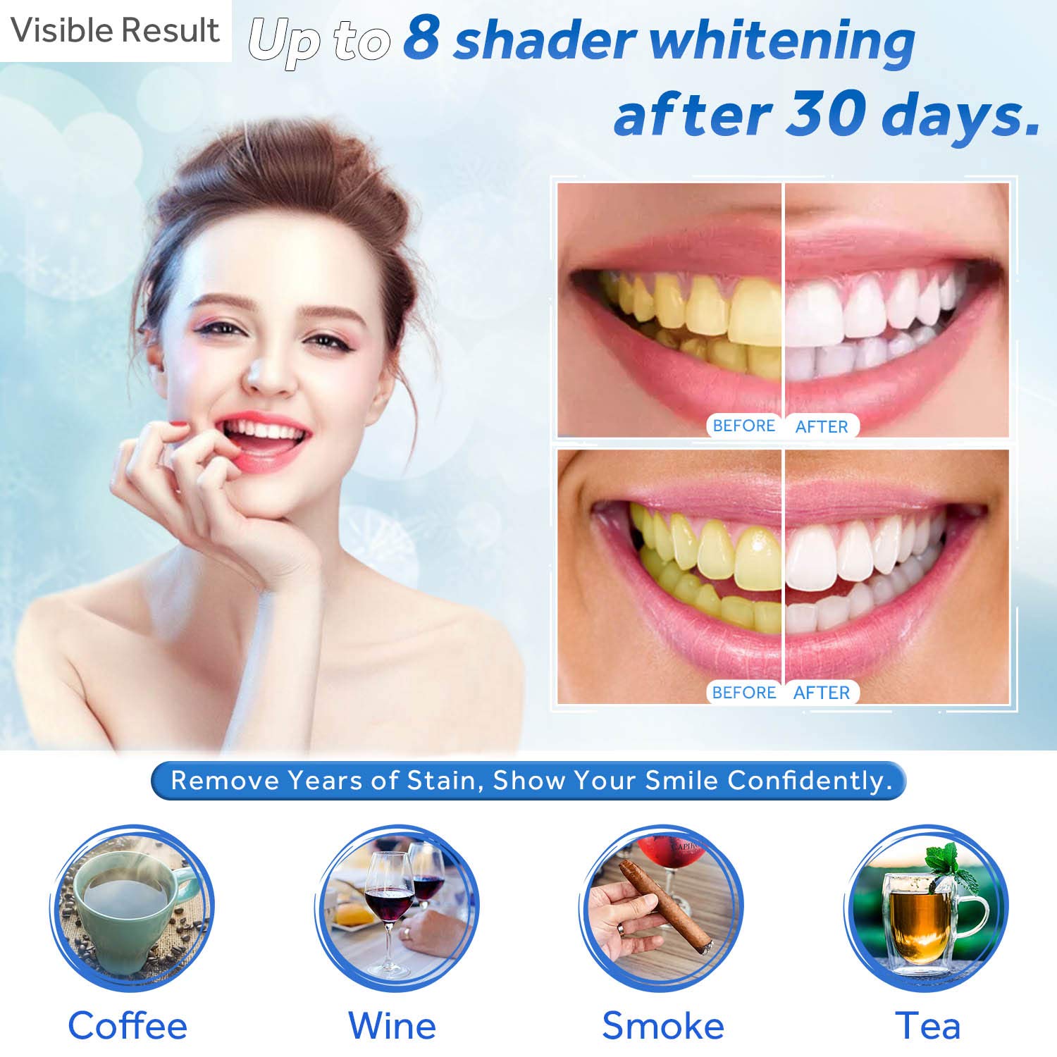 Teeth Whitening Gel Refill Syr - Teeth Whitening Session 리뷰 및 가격
