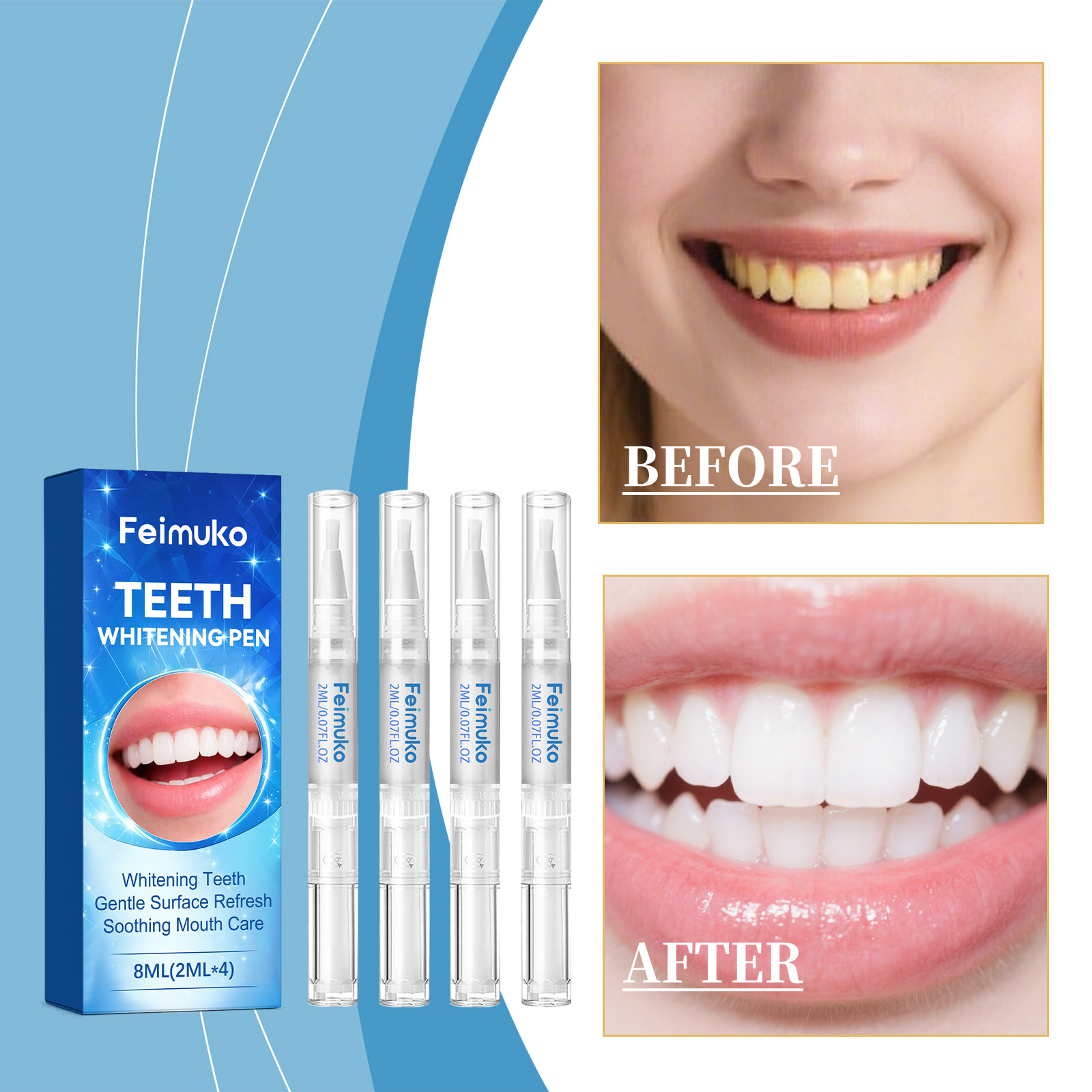 Feimuko 8ml Teeth Gel Pen Gent - Teeth Whitening Price 리뷰 및 가격