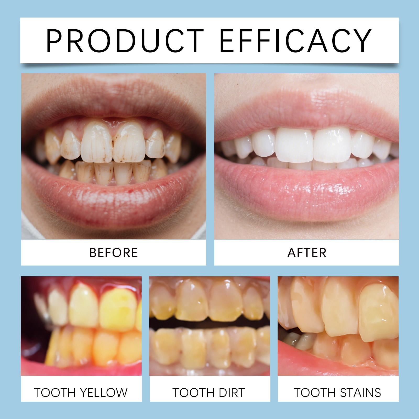 Feimuko 8ml Teeth Gel Pen Gent - Teeth Whitening Price 리뷰 및 가격