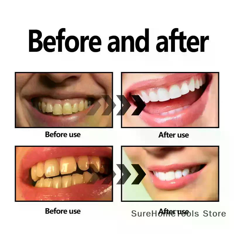 Bamboo Charcoal Powder For Tee - Teeth Paint Whitening 리뷰 및 가격