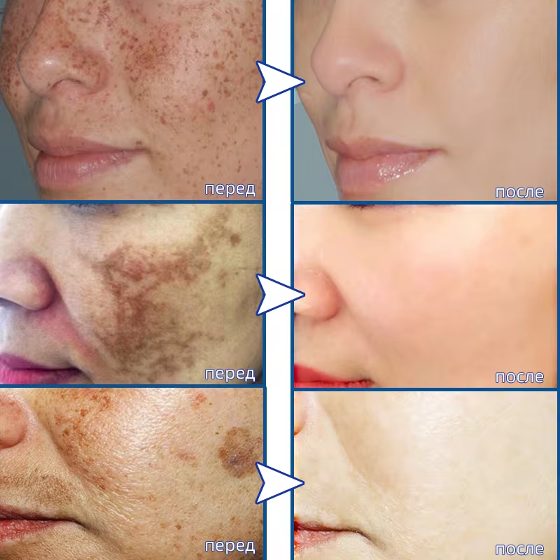 Powerful Spot-removing Whiteni - Charcoal Whitening Paste 리뷰 및 가격