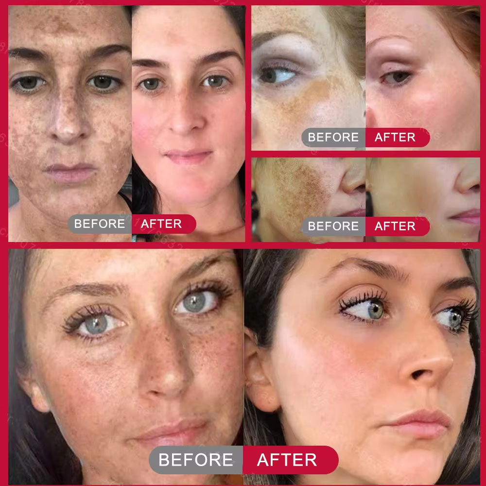 Powerful Spot-removing Whiteni - Charcoal Whitening Paste 리뷰 및 가격