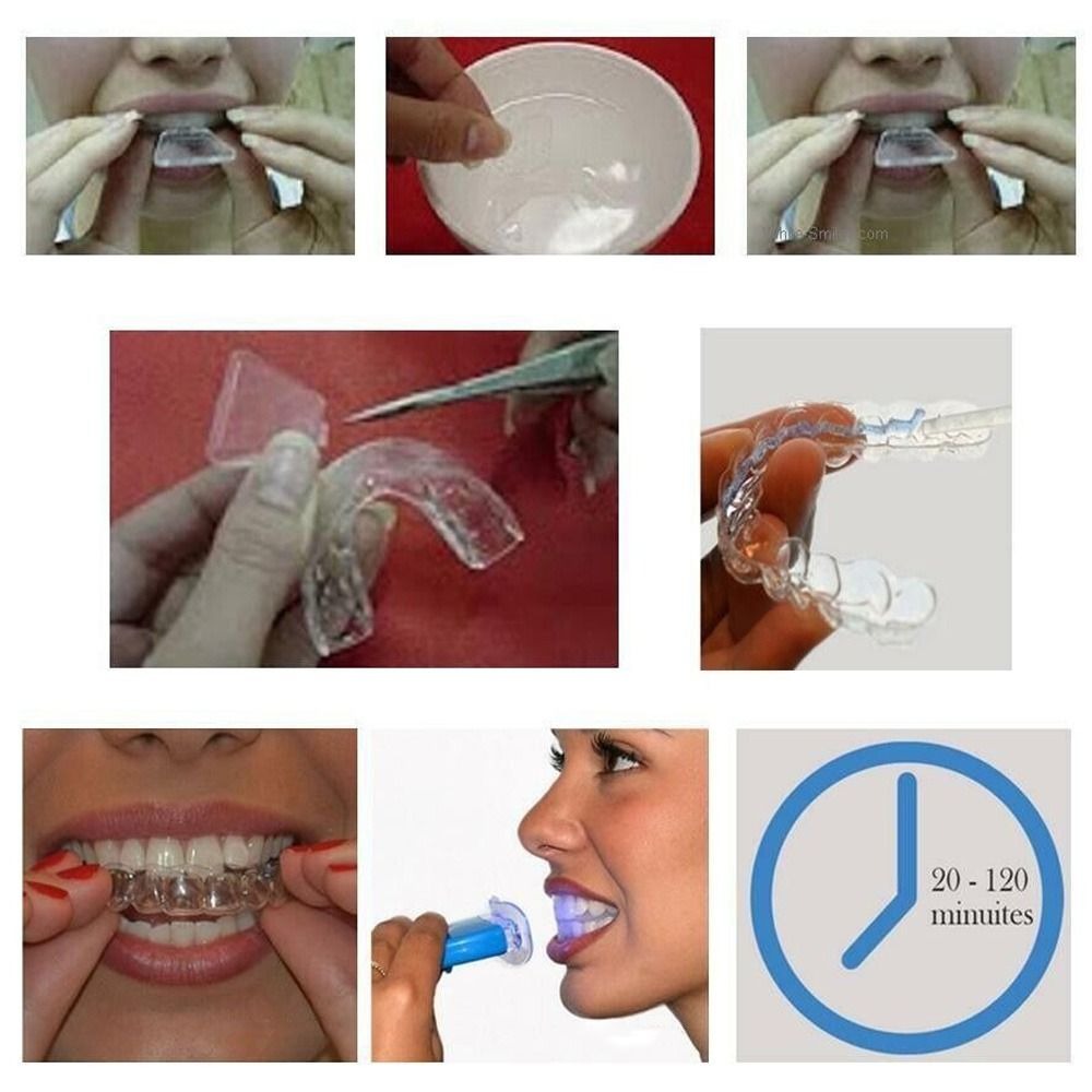 Silicone Night Mouth Guard Too - Dental Guard Night 리뷰 및 가격