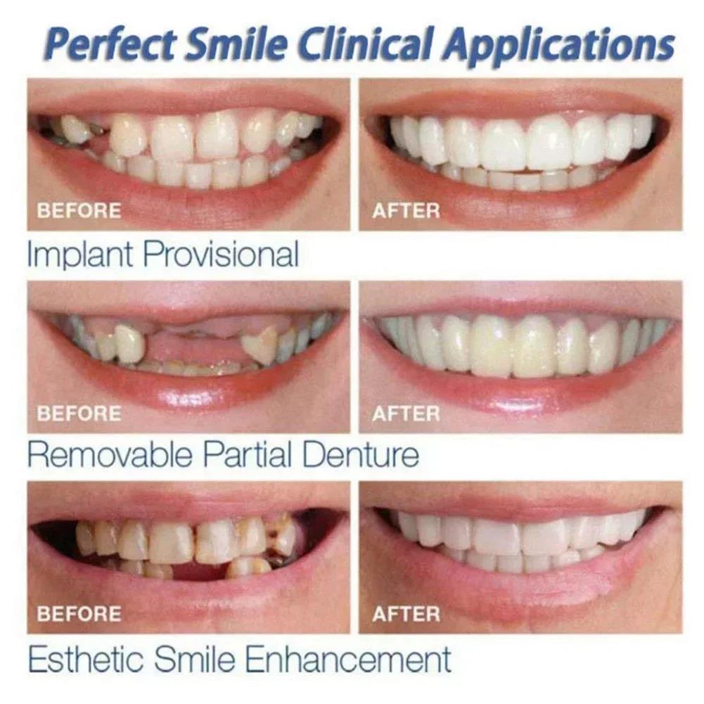 Best Sellers  Teeth Kit Fake T - Teeth Whitening Session 리뷰 및 가격