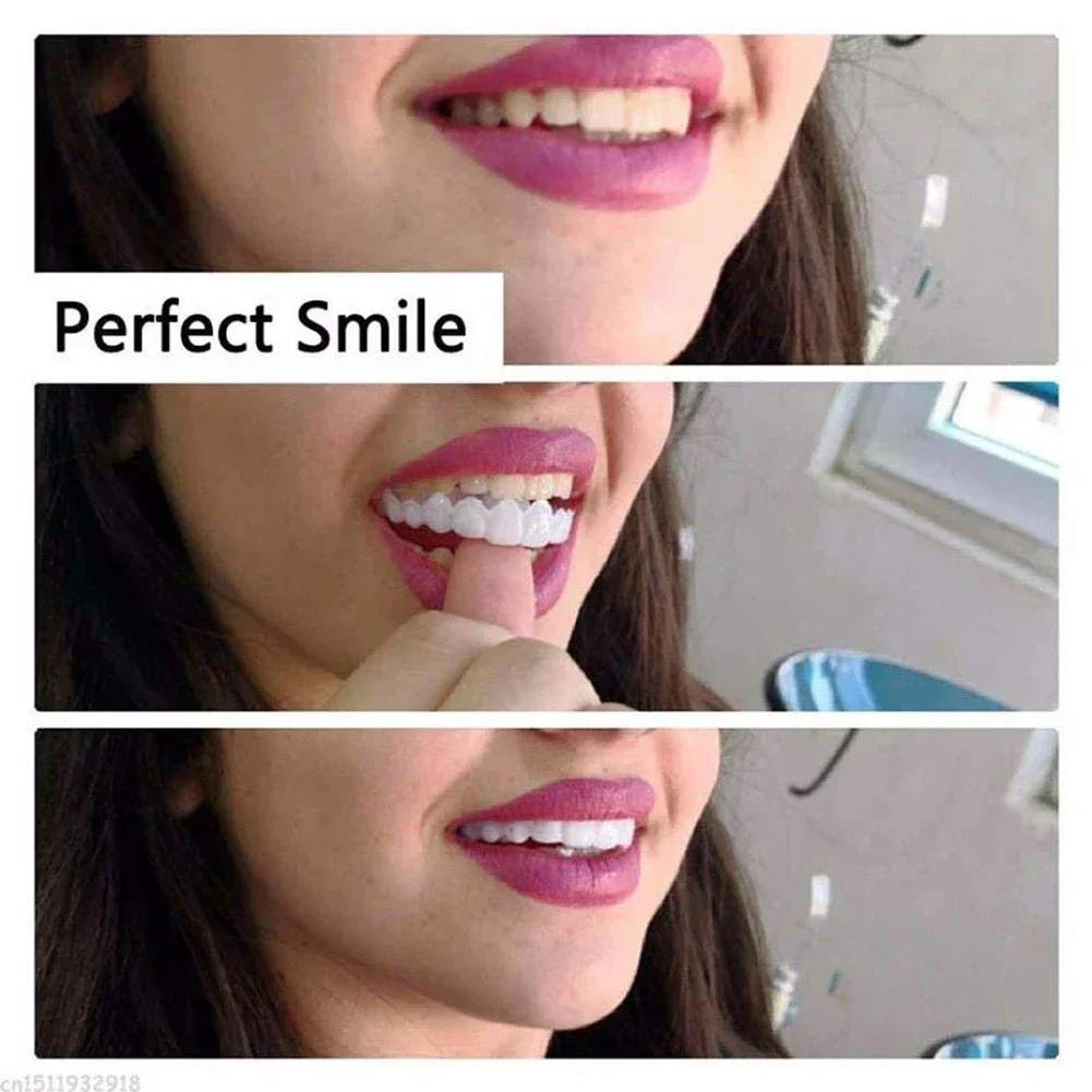 Best Sellers  Teeth Kit Fake T - Teeth Whitening Session 리뷰 및 가격