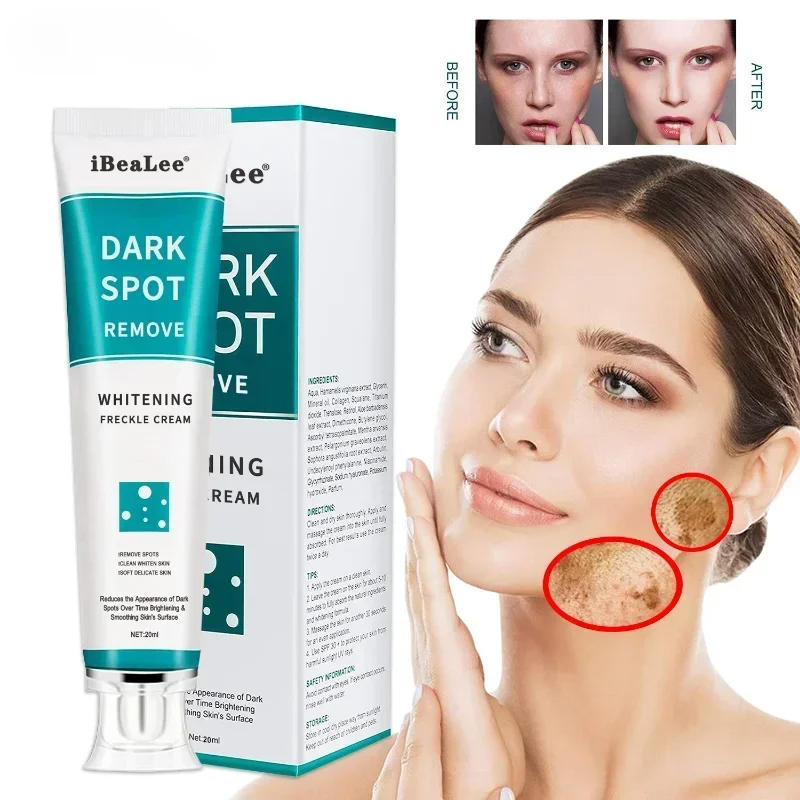 Whitening Freckle Cream Remove - Charcoal Whitening Paste 리뷰 및 가격