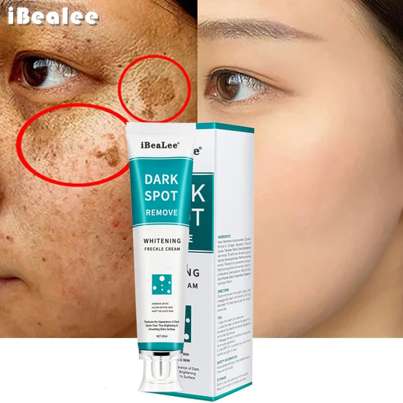 Whitening Freckle Cream Remove - Charcoal Whitening Paste 리뷰 및 가격