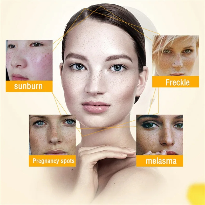 Whitening Freckle Cream Remove - Charcoal Whitening Paste 리뷰 및 가격