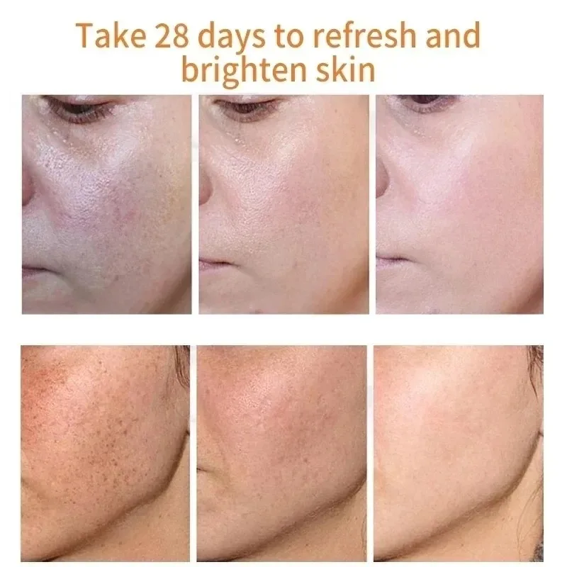 Fades Freckle Dark Spots Face  - Charcoal Whitening Paste 리뷰 및 가격