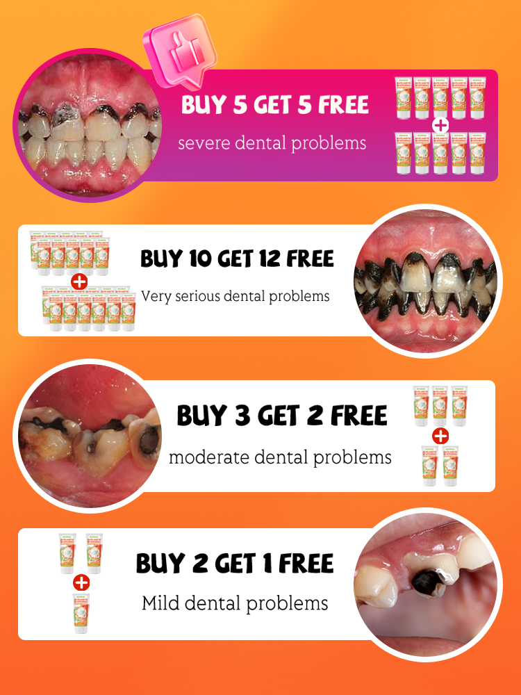 Repair tooth decay and whiten  - Teeth Whitening That Works 리뷰 및 가격