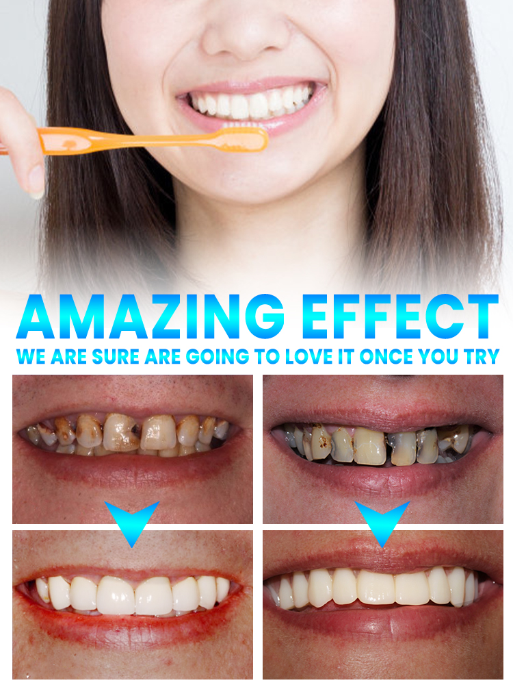 Repair tooth decay and whiten  - Teeth Whitening That Works 리뷰 및 가격