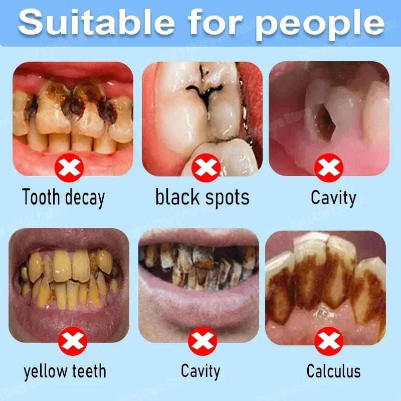 Anti Decay Toothpaste repairs  - Teeth Whitening That Works 리뷰 및 가격