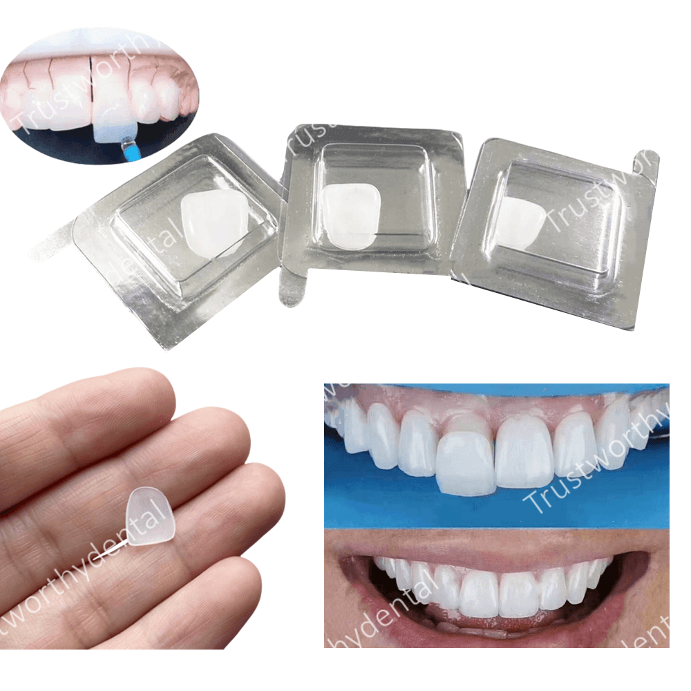 Dental Composite Porcelain Ven - Teeth Paint Whitening 리뷰 및 가격