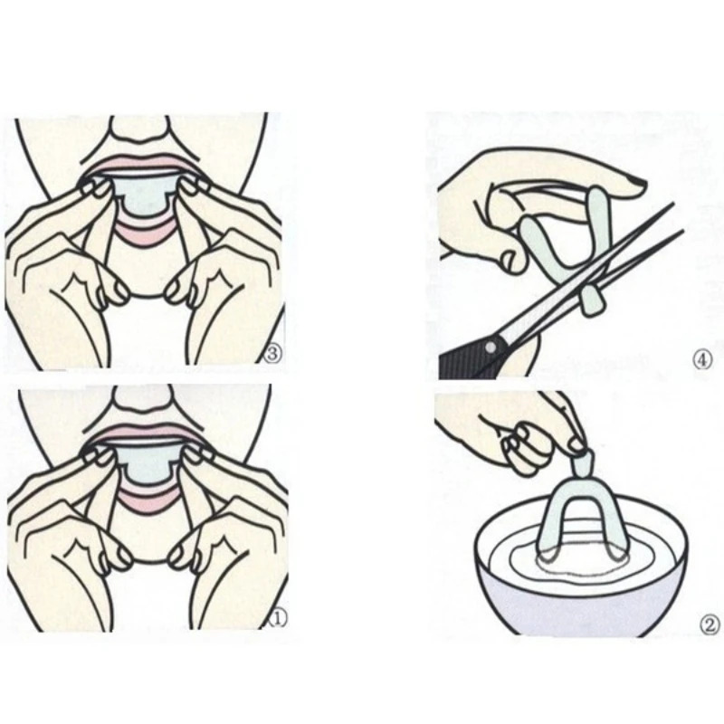 2/4/12PCS Anti Snoring Sleepin - Dental Guard Night 리뷰 및 가격