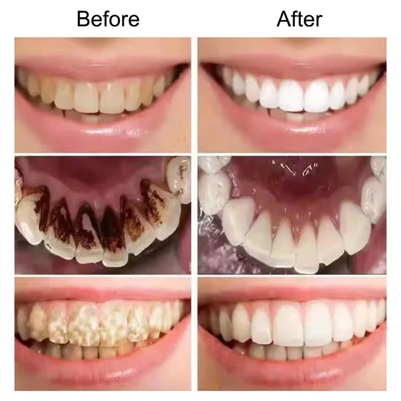 7.5% Hydroxyapatite Probiotic  - Teeth Whitening That Works 리뷰 및 가격
