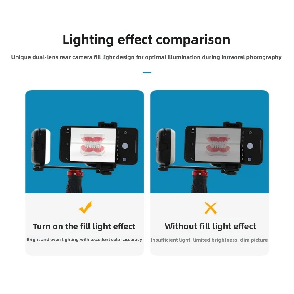 Dental Photography Light, Blue - Teeth Whitening Session 리뷰 및 가격