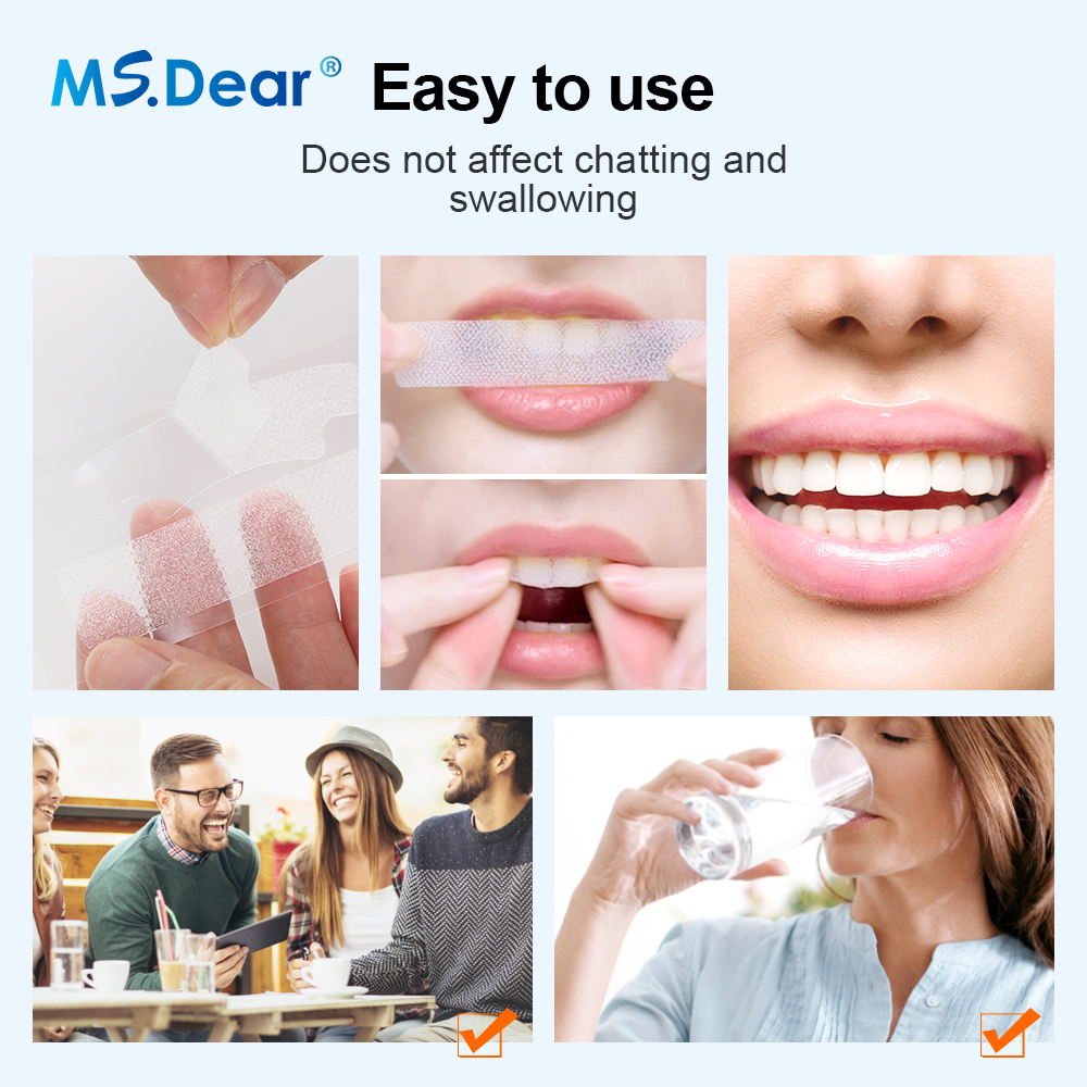 Teeth Whitening Strips Cleansi - Teeth Whitening Session 리뷰 및 가격